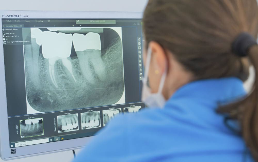Zahnärztin analysiert Röntgenbilder: Die Zahnzusatzversicherung ist eine beliebte Krankenzusatzversicherung der Deutschen
